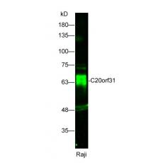 Anti-C20orf31 antibody