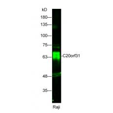 Anti-C20orf31 antibody