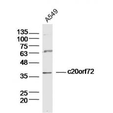 Anti-c20orf72 antibody