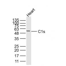 Anti-C1s antibody