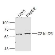 Anti-C21orf25 antibody