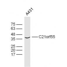 Anti-C21orf55 antibody