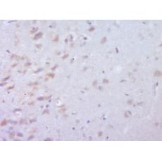 Anti-C22orf25 antibody