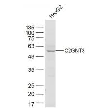 Anti-C2GNT3 antibody