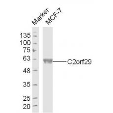 Anti-C2orf29 antibody