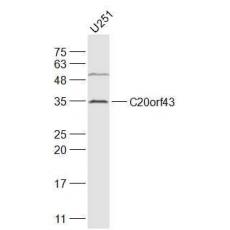 Anti-C20orf43 antibody