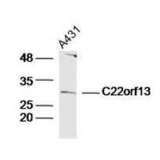 Anti-C22orf13 antibody