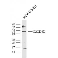 Anti-C2CD4D antibody