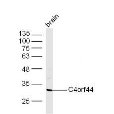 Anti-C4orf44 antibody