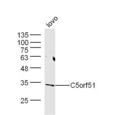Anti-C5orf51 antibody