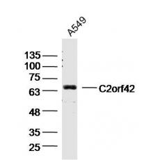 Anti-C2orf42 antibody