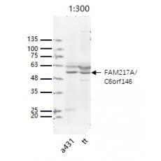 Anti-C6orf146 antibody