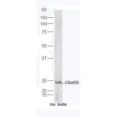 Anti-C6orf25 antibody