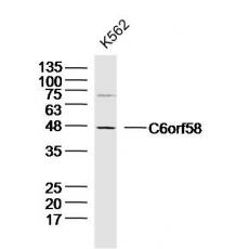 Anti-C6orf58 antibody