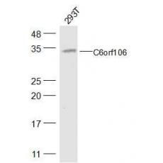 Anti-C6orf106 antibody