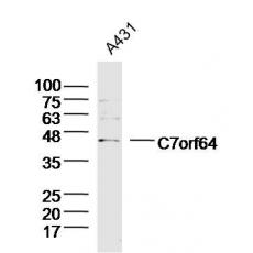 Anti-C7orf64 antibody