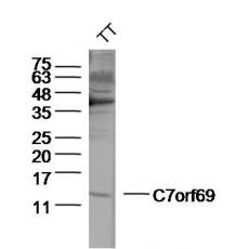 Anti-C7orf69 antibody