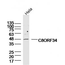 Anti-C8ORF34 antibody