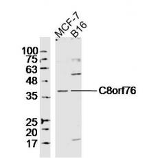 Anti-C8orf76 antibody
