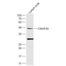 Anti-C9orf140 antibody