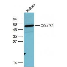 Anti-C9orf72 antibody