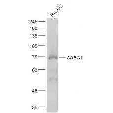 Anti-CABC1 antibody