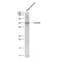 Anti-CADM2 antibody