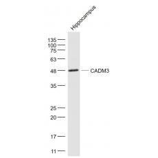 Anti-CADM3 antibody