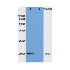 Anti-Nociceptin antibody