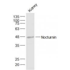 Anti-Nocturnin antibody