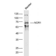 Anti-NOR1 antibody