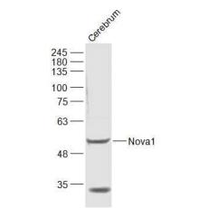 Anti-Nova1 antibody