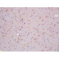 Anti-SLCO2B1 antibody