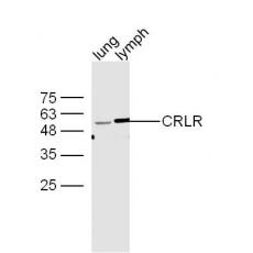 Anti-CALCRL antibody