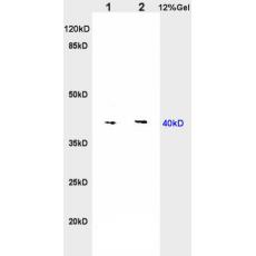 Anti-Nociceptin receptor antibody