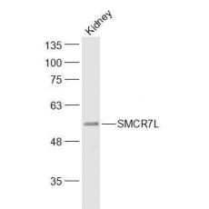Anti-SMCR7L antibody