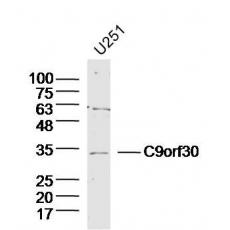 Anti-C9orf30 antibody
