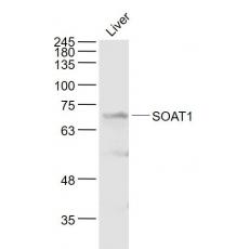 Anti-SOAT1 antibody