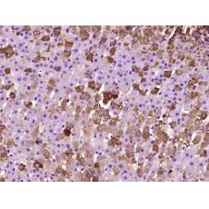 Anti-SOAT2 antibody
