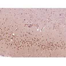 Anti-SOX4 antibody
