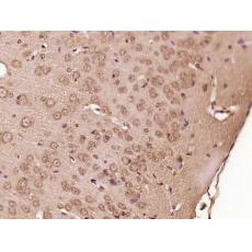 Anti-SPAG16 antibody