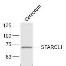 Anti-SPARCL1 antibody