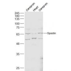 Anti-Spastin antibody