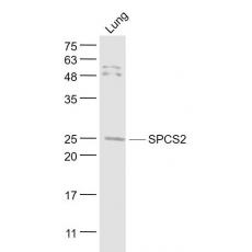 Anti-SPCS2 antibody