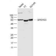 Anti-SPDYE3 antibody
