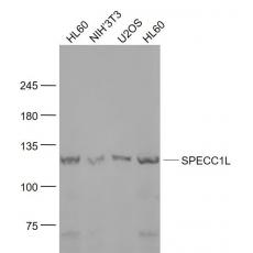 Anti-SPECC1L antibody