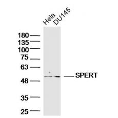 Anti-SPERT antibody