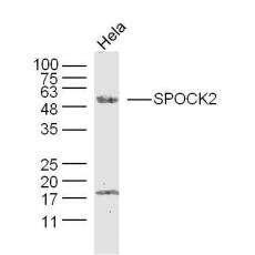 Anti-SPOCK2 antibody