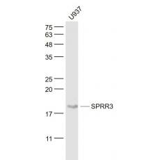 Anti-SPRR3 antibody