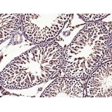 Anti-StAR antibody